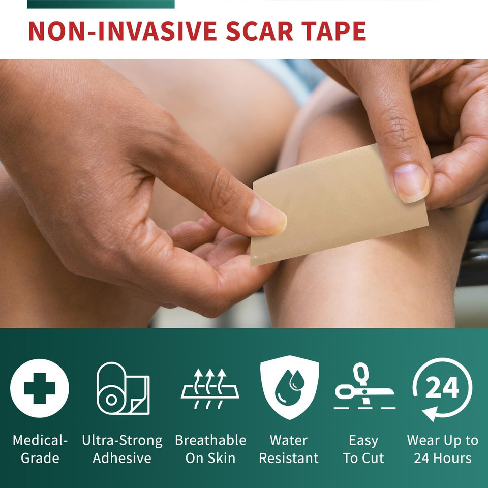Medical Grade Silicone Scar Tape Advanced Adhesive Formulation (1.6" X 118") Scar Removal Away Strips For Surgical Scars, Silicone Tape & Keloid Scar Treatment, Reusable Silicone Scar Sheets