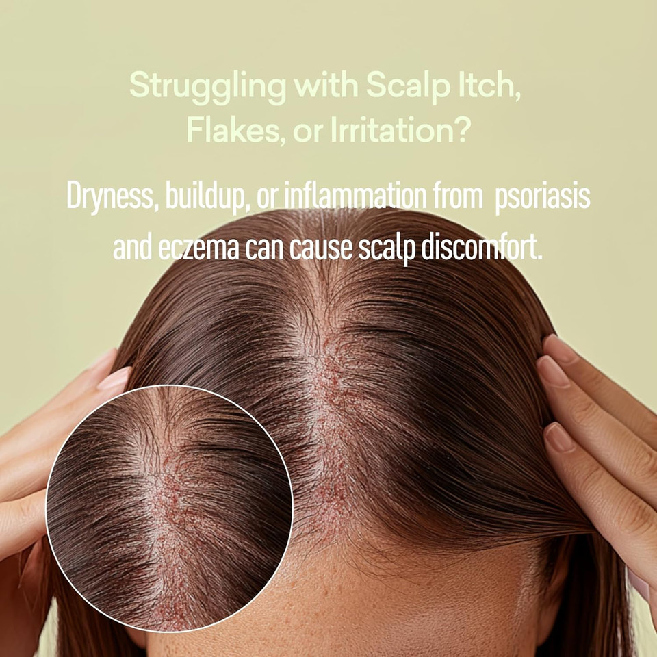 Psoriasis Soften Scalp Vinegar Rinse Cleanser | Natural Cleanser For Psoriasis, Eczema And Scalp Problems | Removes Residue | Apple Cider Vinegar Cleanser For Psoriasis | Just Nutritive | 8 Fl Oz