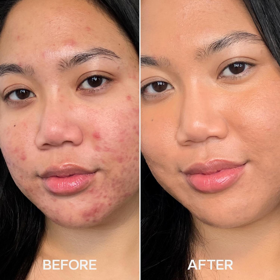 Saie Hydrabeam Under Eye Brightener - Sheer + Hydrating Eye Brightener With Cucumber Extract - Instantly Illuminates Skin For A Radiant Finish - Shade 4 (0.2 Oz)