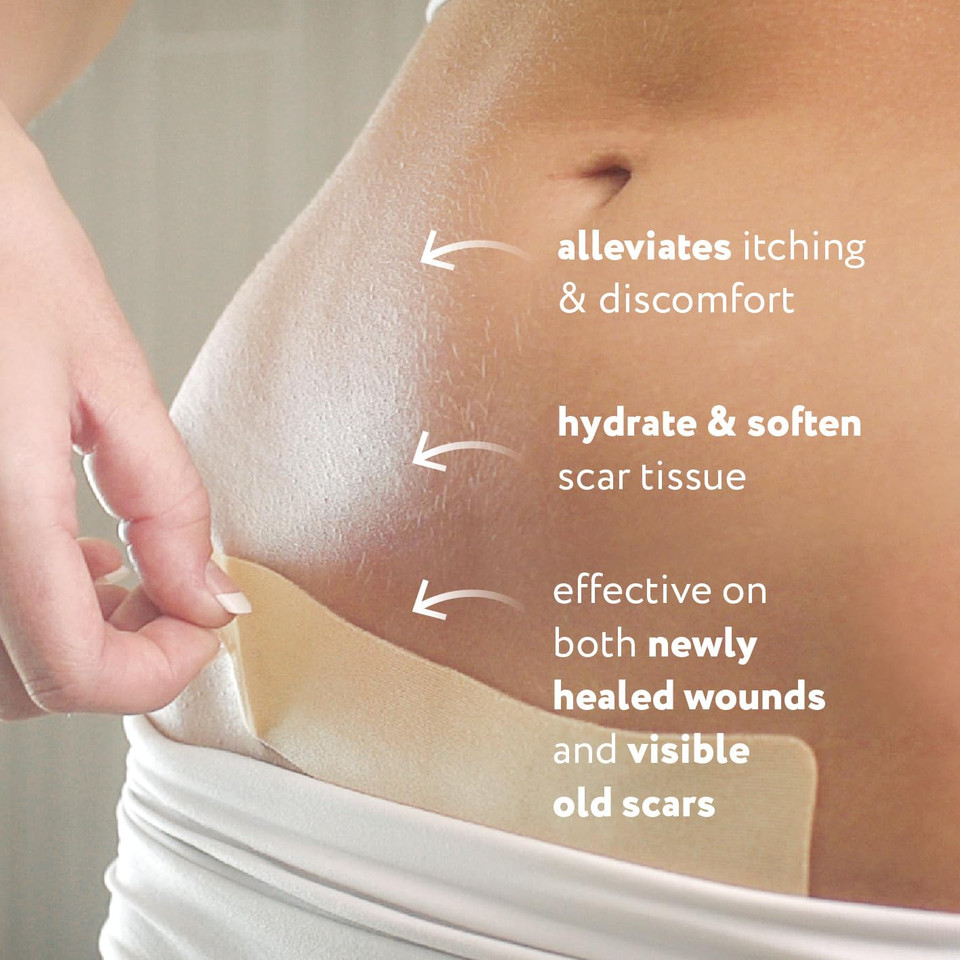 Scaraway Advanced Silicone Scar Sheets For C-Section, Reusable Strips (1.5 X 7) For Hypertrophic And Keloid Scars From C-Section & Other Surgeries, 4 Sheets