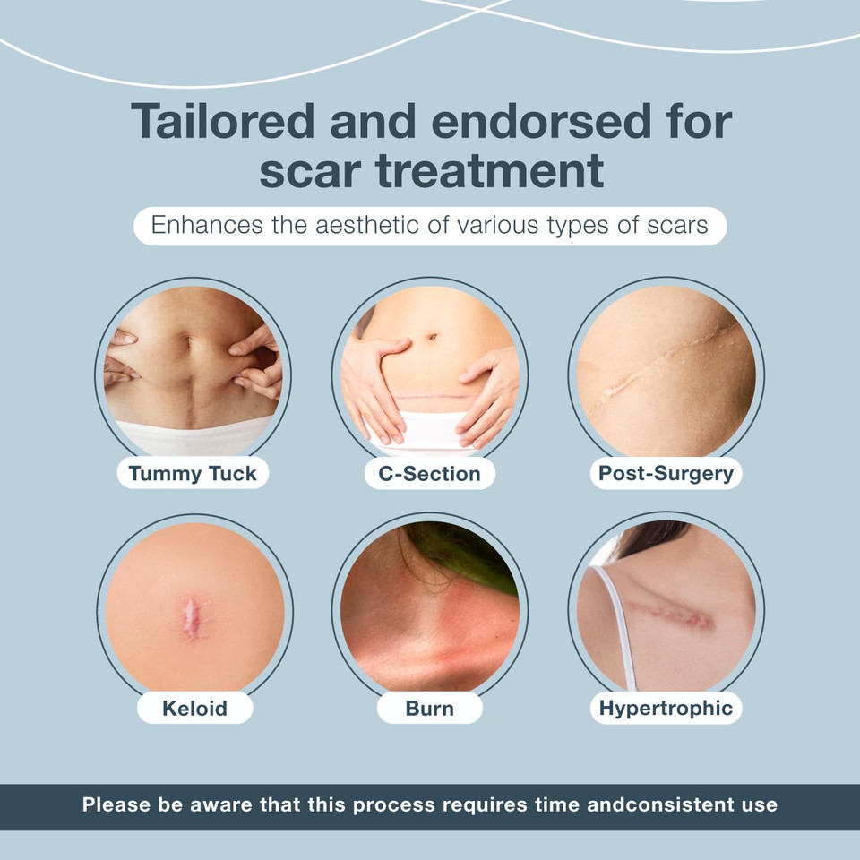 Silicone Scar Sheets, Scar Tape For Surgical Scars, 120" X 1.6" Roll - C-Section, Tummy Tuck, Keloid Scar Treatment, As Post Surgical Cream, Gel, Scar Patches, Surgery Scar Removal, Strips For Scars