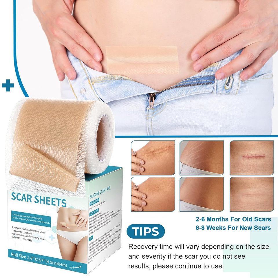 Silicone Scar Sheets, Silicone Scar Tape(1.8X 157 Roll-4M), Silicone Scar Strips, Professional Scar Removal Sheets For Surgical Scars, Keloid, C-Section, Burn Et