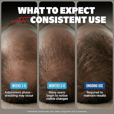 Minoxidil for Men Bundle Liquid Extra Strength Hair Regrowth Treatment 5%, 6 Months Supply - Dropper Applicator and Bonus Free Guide Included