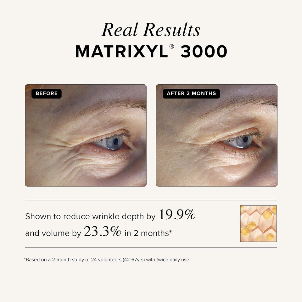 Asterwood Matrixyl 3000 + Argireline Serum for Face - Multi Peptide Serum with Hyaluronic Acid - Anti-Aging, Wrinkle Reducing, Collagen Boosting - Fragrance-Free