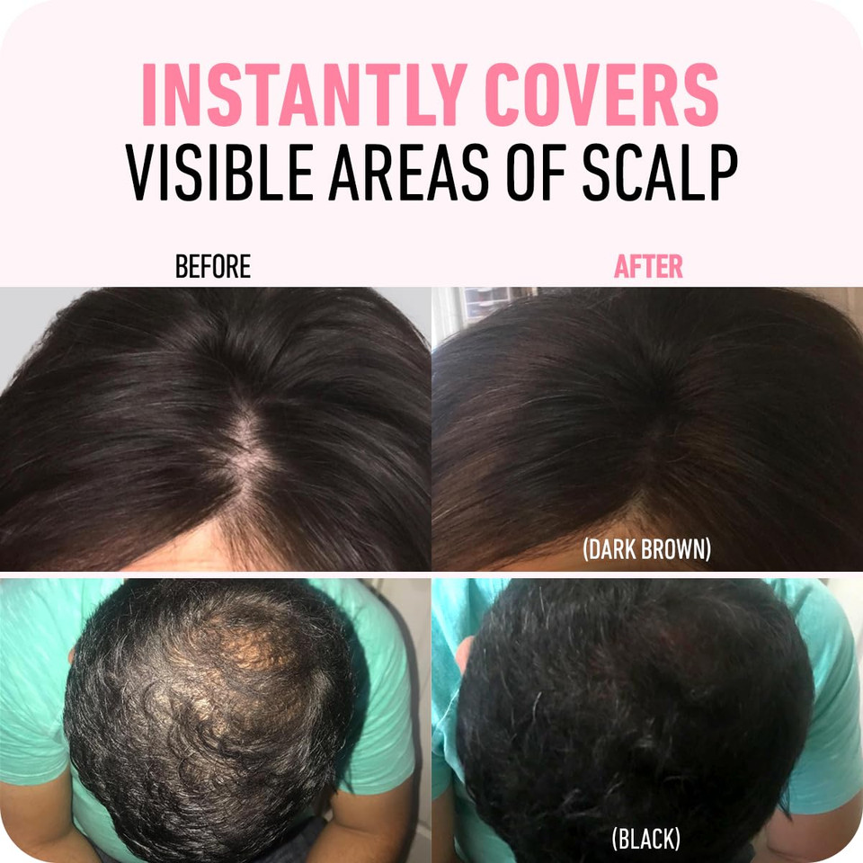 Hairline Powder (Black) + Hair Fiber (Black): Boldify Bundle That Instantly Conceals Hair Loss Hair Powder For Thinning Hair, Root Cover Upblack