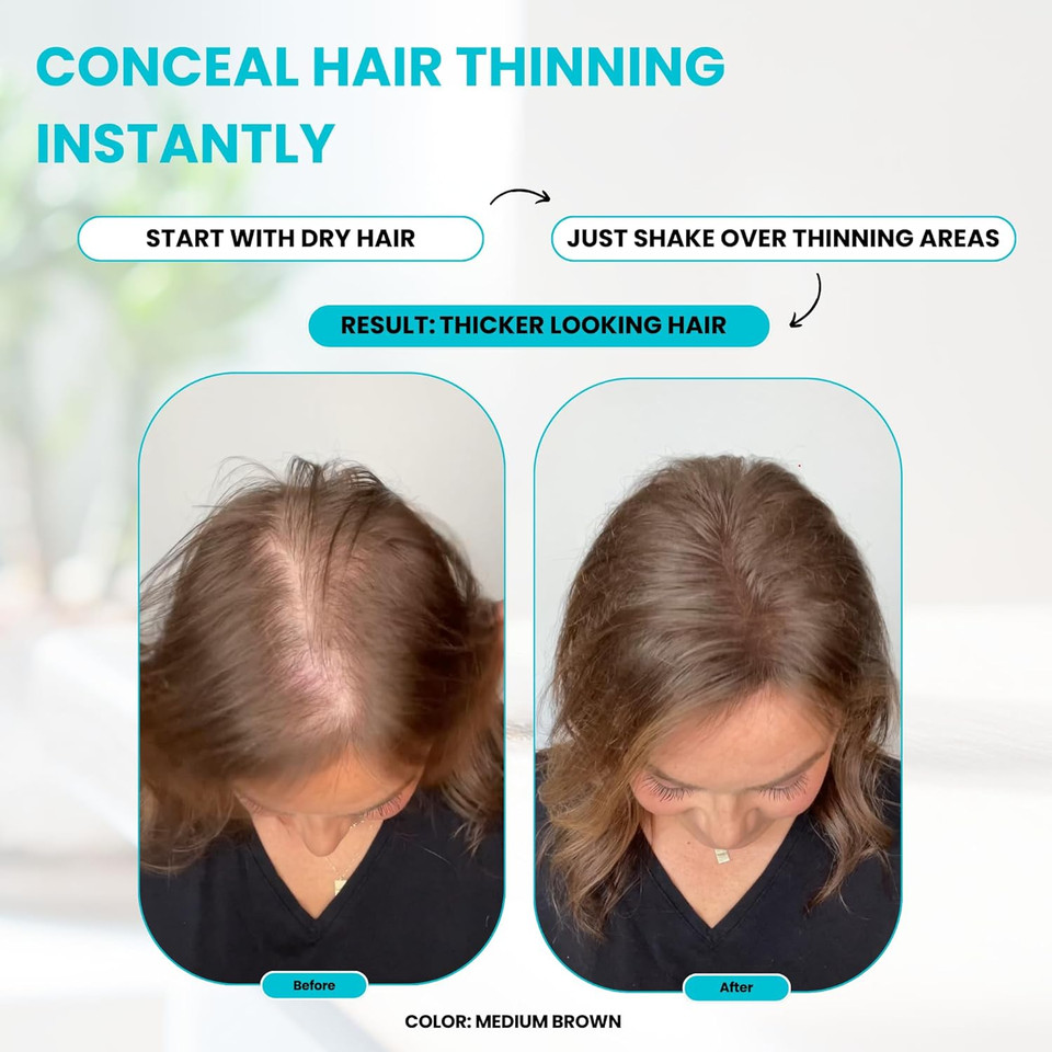 Surethik Hair Fibers For Thinning Hair, Building Hair Fibers To Conceal Thinning Hair, Instantly Fuller Looking Hair For Men & Women, Sandy Blonde, 15Gsandy Blonde15G