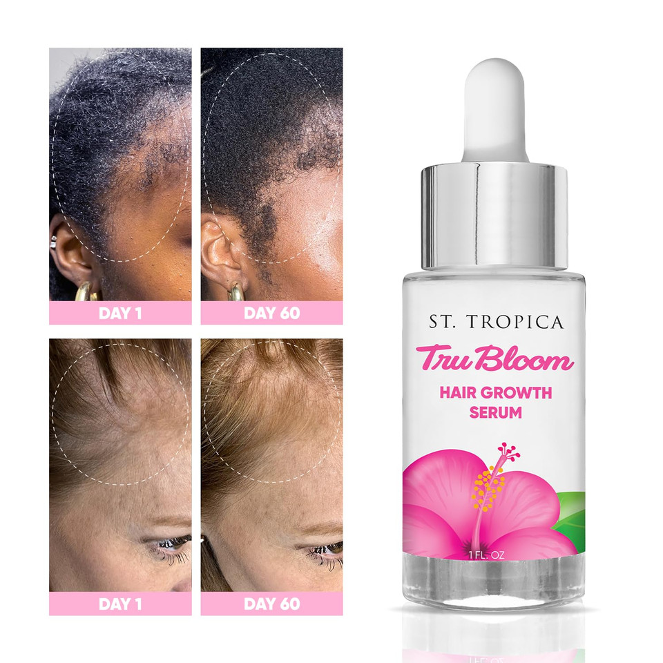 St. Tropica Tru Bloom Hair Growth Serum For Fuller, Thicker Hair | With Scientifically Proven Ingredients Like Peppermint Oil, Caffeine, Saw Palmetto, Green Tea Extract, Red Ginseng & More