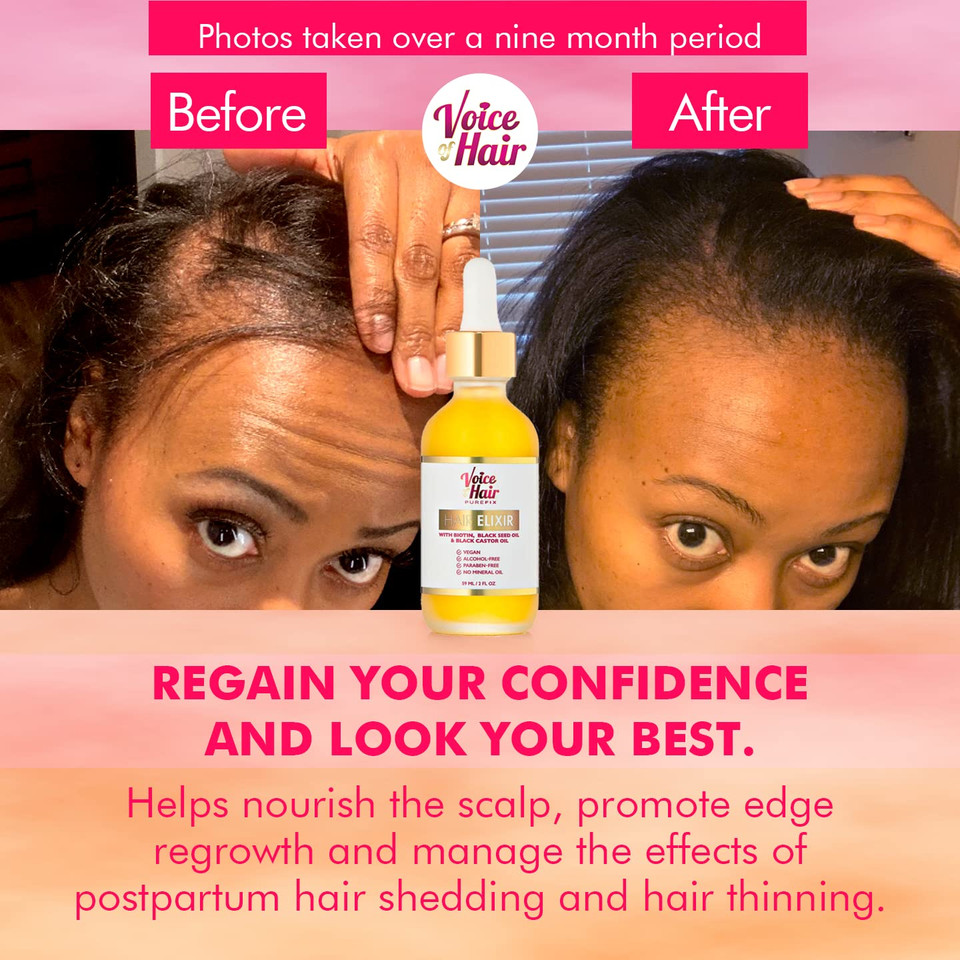 Voice Of Hair Purefix Elixir ÃÂ Hair Growth Oil Serum ÃÂ Clinically Proven 6-In-1 Hair And Scalp Oil For Longer, Stronger, And Moisturized Hairã¢Â With Rosemary Oil ÃÂ Vegan - Paraben Free - 2 Fl Oz