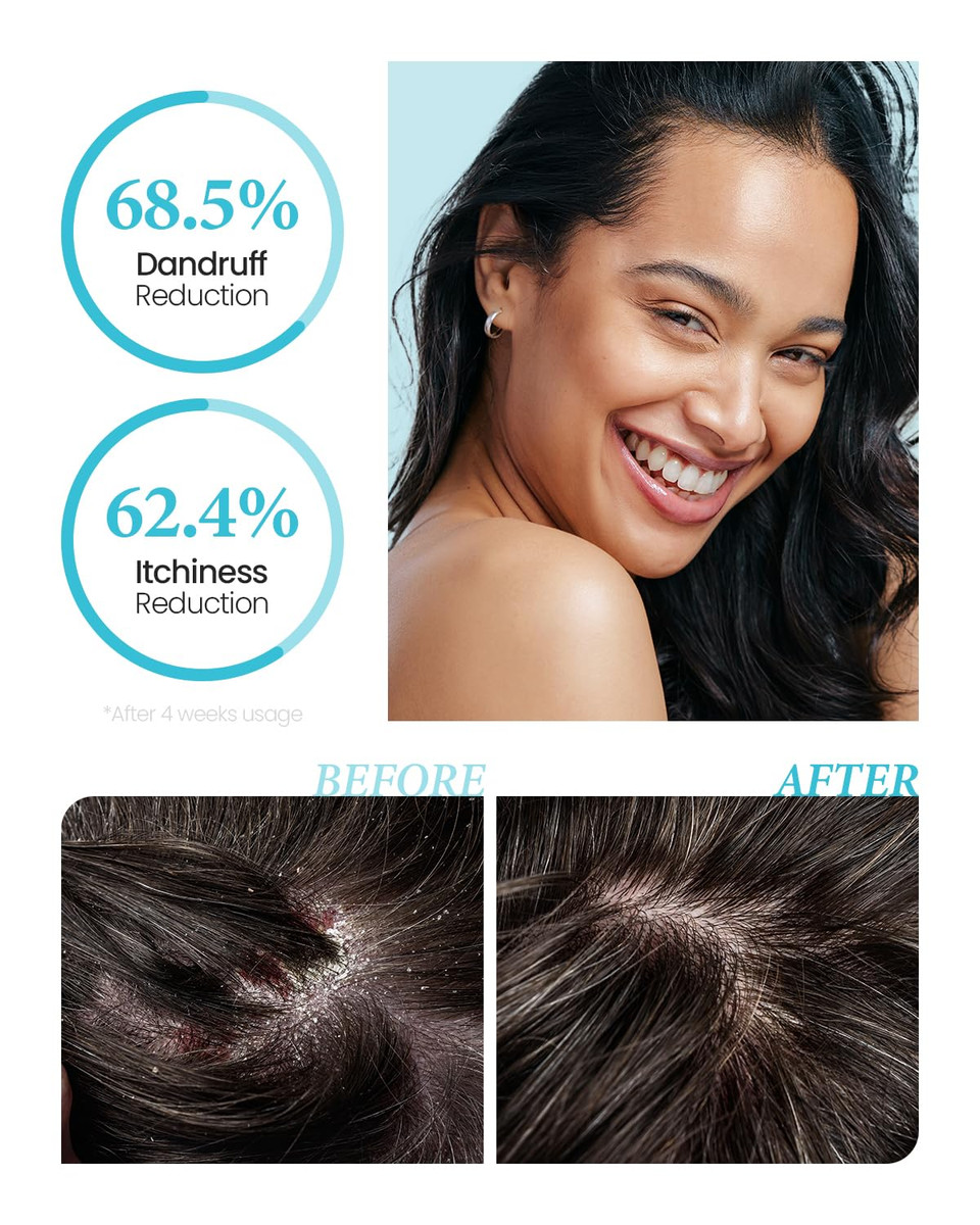 Kundal Pro Deep Cleansing Anti-Dandruff Shampoo - Reduce Flakes, Relieves Itchiness & Scalp Irritation, Scalp Clarifying, Remove Excess Oil 2Ea/Set (White Musk)