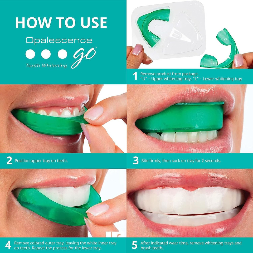 Opalescence Go - Prefilled Teeth Whitening Trays - 15% Hydrogen Peroxide - Made By Ultradent - Cool Mint Flavor - Fluoride B-5194-1