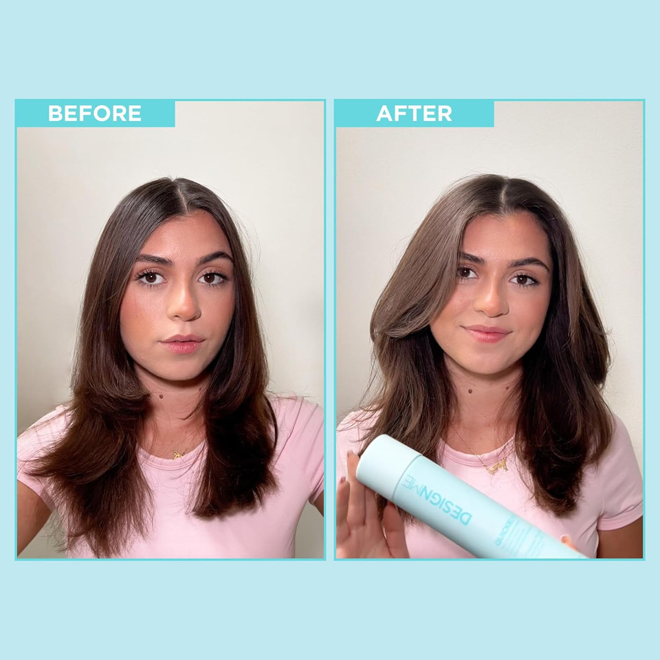 Quickie.Me Dry Shampoo Hair Spray By Designme | Oil-Absorbing, Residue-Free Dry Shampoo | Root-Lifting Dry Shampoo Spray | Waterless Dry Shampoo Spray With Rice Starch, 7 Oz