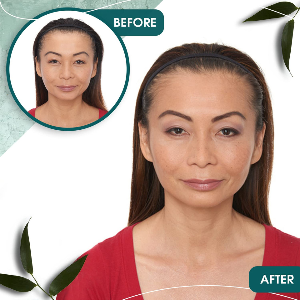 Grofully Womenã¢ÂS Hair Regrowth Kit - Gold | 3-Step System | Shampoo, Conditioner, And 2% Minoxidilwomen