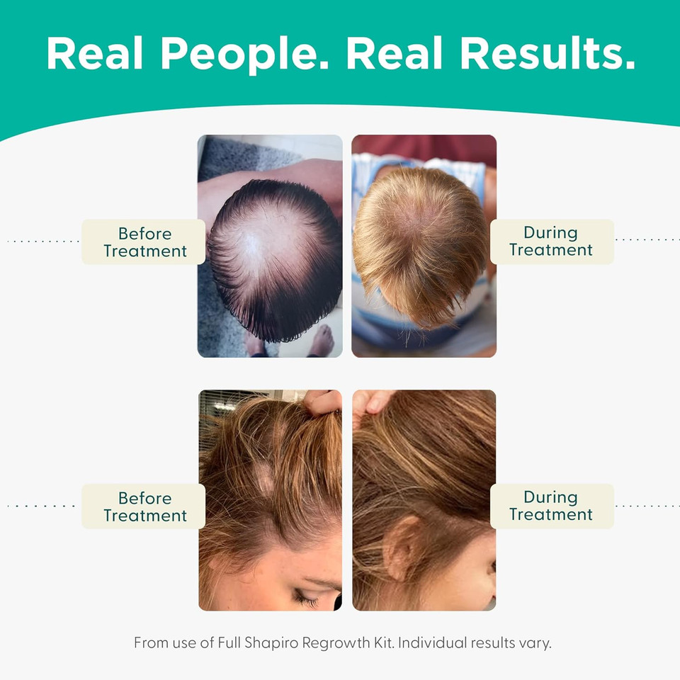 Shapiro Md Natural Hair Kit For Thicker, Fuller, Healthier Looking Hair - Including Shampoo, Conditioner, And Leave-In Daily Foam (1 Month Supply)