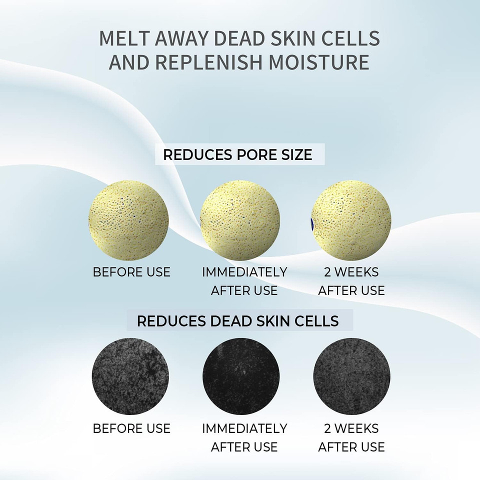 Snp Prep Clayronic Pore Toner 7.43 Fl Oz - Purifies Pores, Calms & Improves Skin Tone - Pore-Reducing, Minimizes Large Pores For Men And Women