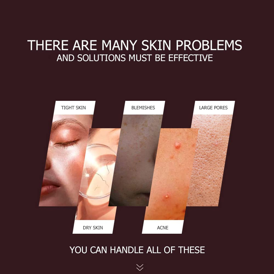 Bioaqua Aloe Vera Extract Pink Gel Hydrating Moisturizing Soothing Skin Care Essence 300G/10.58Oz Bioaqua Aloe Vera Extract Pink Gel Hydrating Moisturizing Soothing Skin Care Essence 300G/10.58Oz