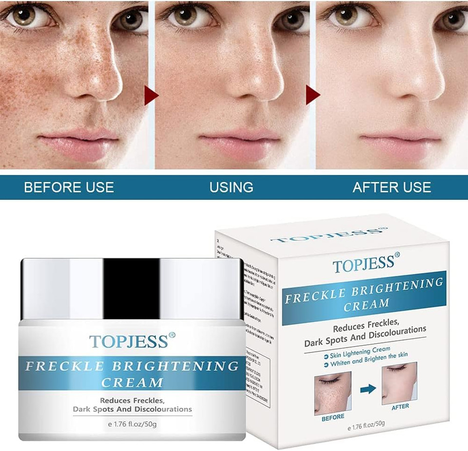 Hope's Relief Derma-Lotion for Dry Skin Cream for Dermatitis Treatment, Ezema and Psoriasis Ultra-Lightweight