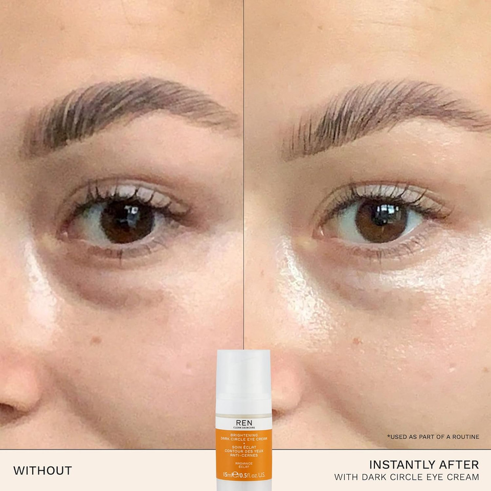 REN Clean Skincare Brightening Dark Circle Eye Cream | Hydrates & Proven to Reduce Dark Spots in 7 Days | Revives & Firms Tired Under Eyes by Evening Skin Tone | Vegan & Cruelty Free | Step 3: Treat