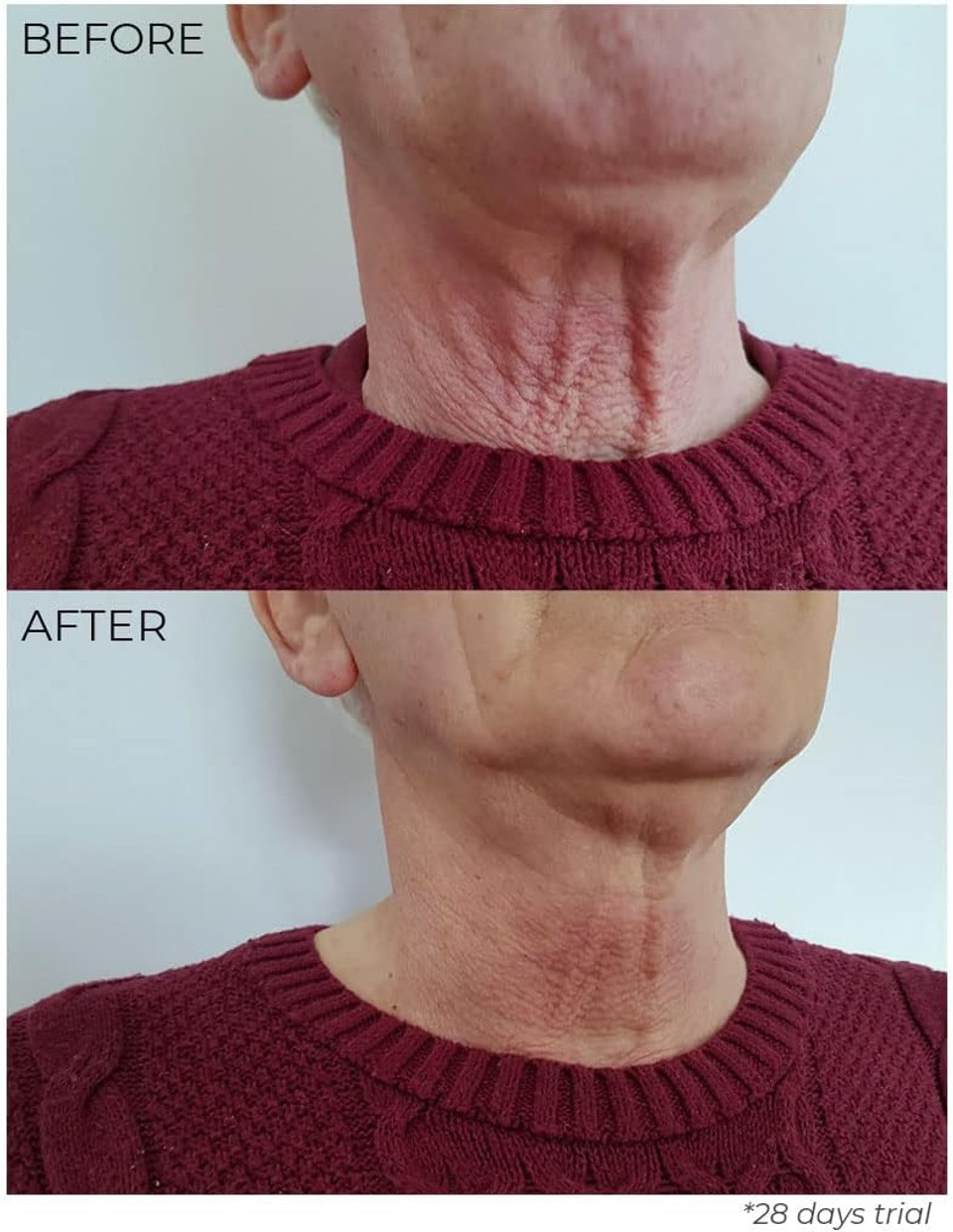 Nourish London Tsl Tighten, Sculpt & Lift Neck Elixir 30Ml | Anti Ageing Neck Cream | Kale And Griffonia Extracts | 100% Vegan | Cruelty-Free | Multi Award Winner