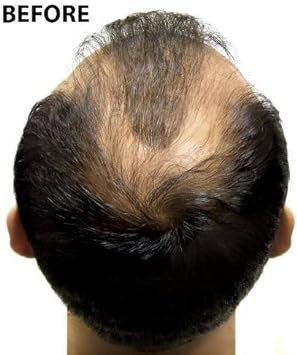 Super Million Hair Intro Set - Ash Blonde