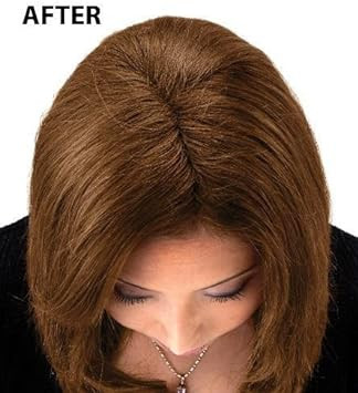 Super Million Hair - 1 X 10G Hair Building Fibres - No.15 White