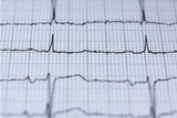 Benefits of Hospitals Standardizing on One Brand of Radiolucent ECG Lead Wires