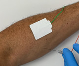 Concentric EMG Needles, Single-Fiber EMG Tests, Cost-Efficiency, and Safety