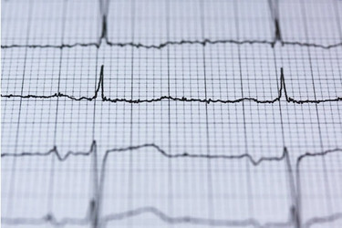 Benefits of Hospitals Standardizing on One Brand of Radiolucent ECG Lead Wires