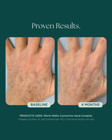 Marini Renu Hand Complex 28g