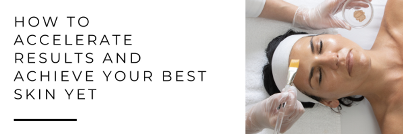 How to accelerate results and achieve your best skin yet