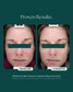Rosalieve 30ml