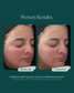 Rosalieve 30ml