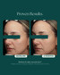 NeuroSmooth 30ml
