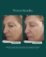 Retinol Plus 28g
