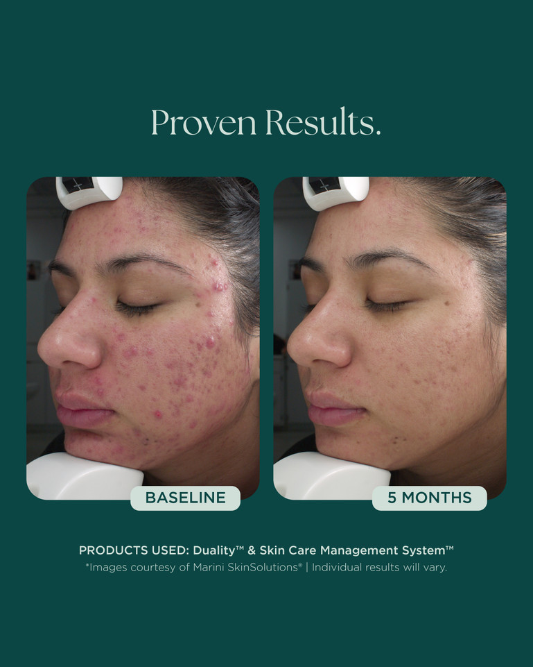 Age Intervention® Duality™ 28g