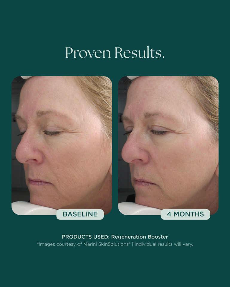 Regeneration Booster 30ml