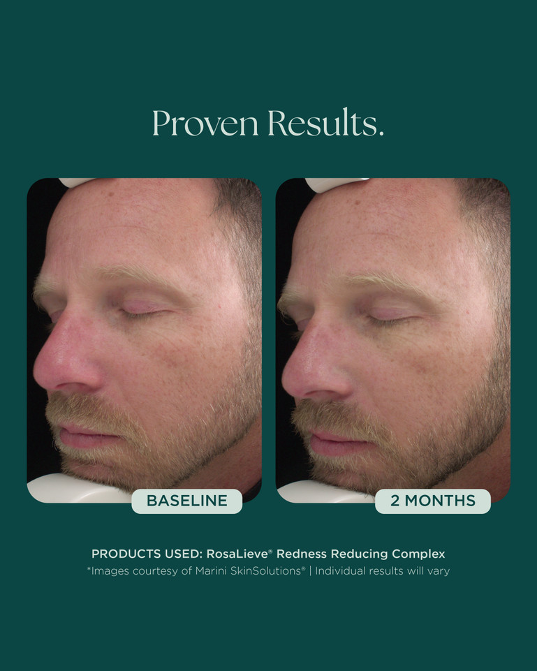Rosalieve 30ml