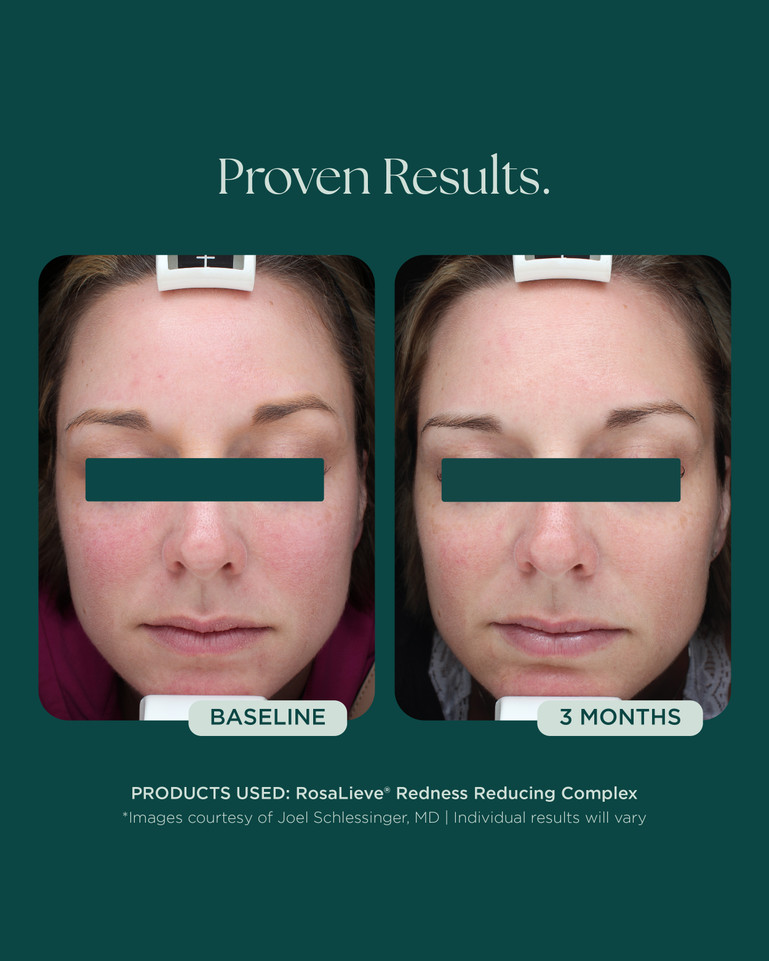 Rosalieve 30ml