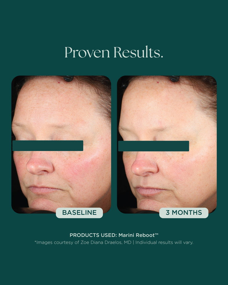 Marini Reboot™ PDRN Face Serum