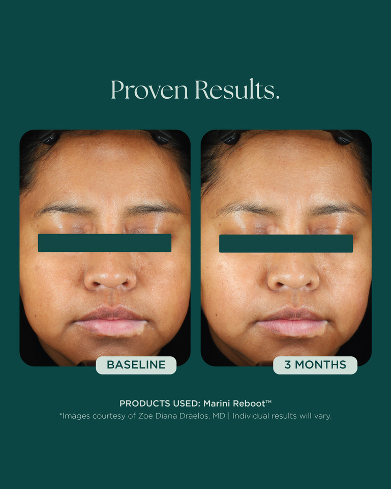 Marini Reboot™ PDRN Face Serum