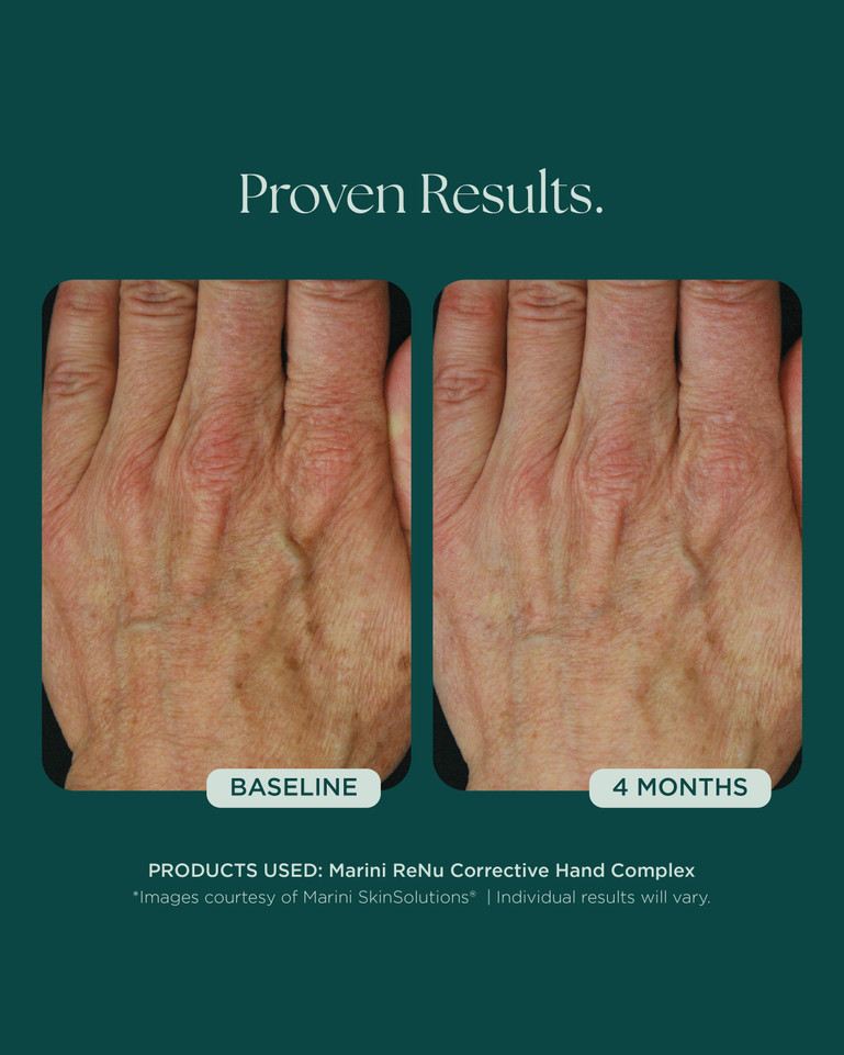 Marini Renu Hand Complex 28g