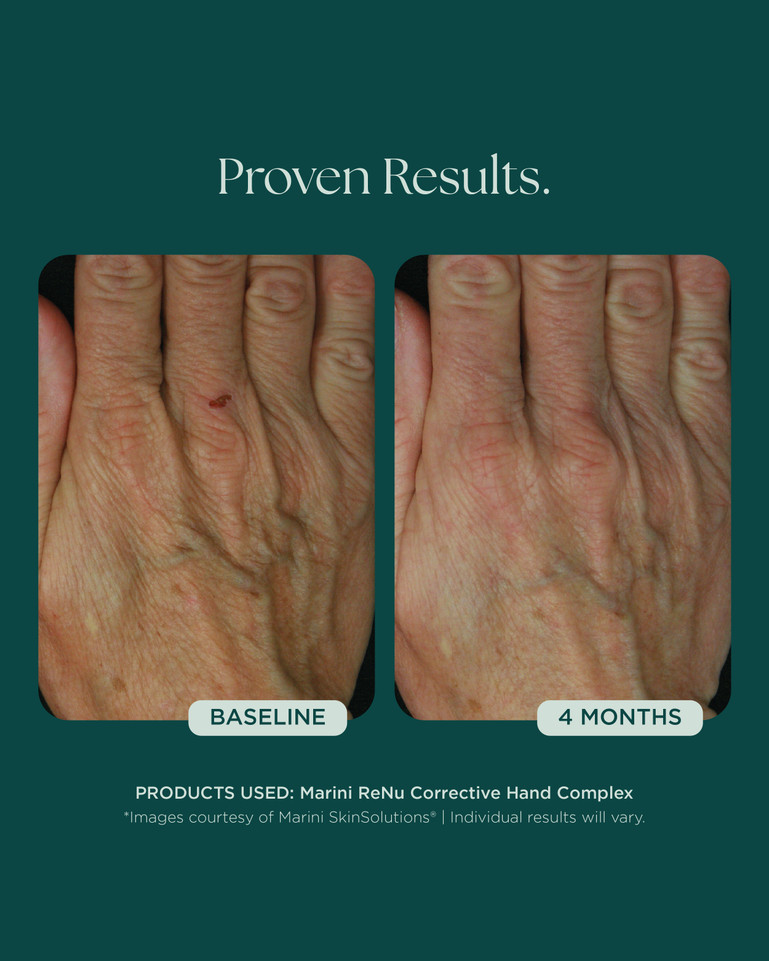Marini Renu Hand Complex 28g
