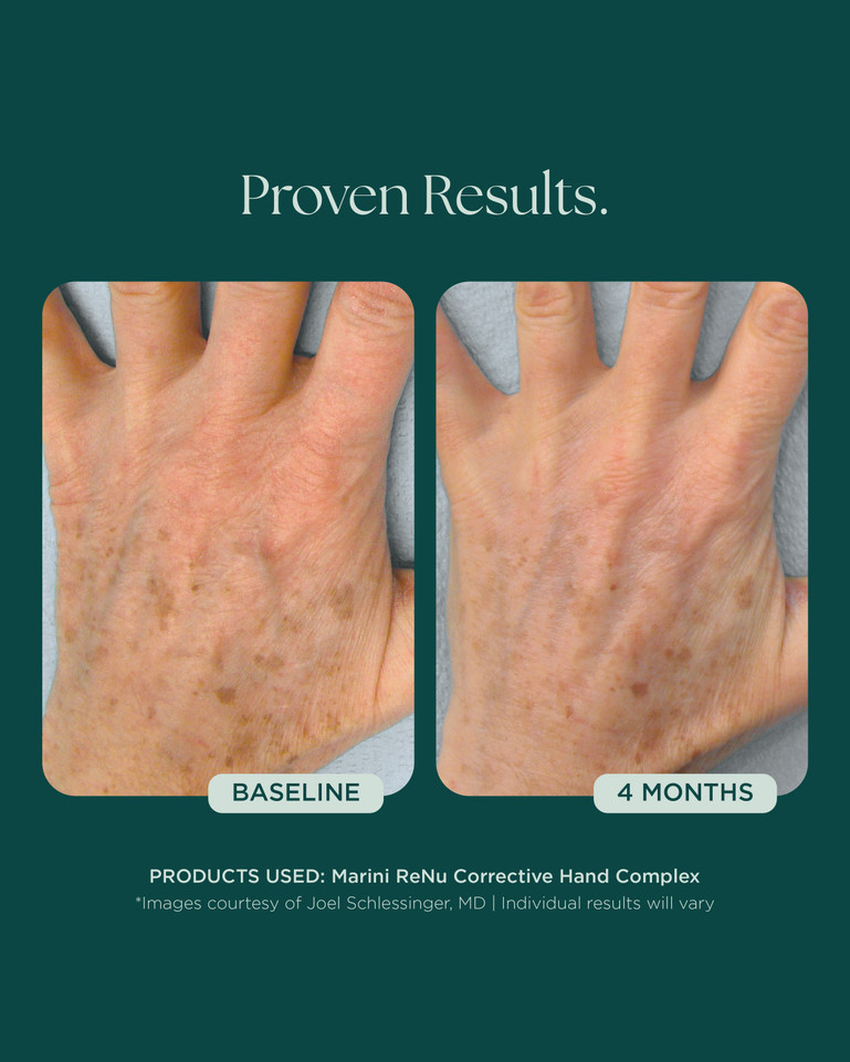 Marini Renu Hand Complex 28g