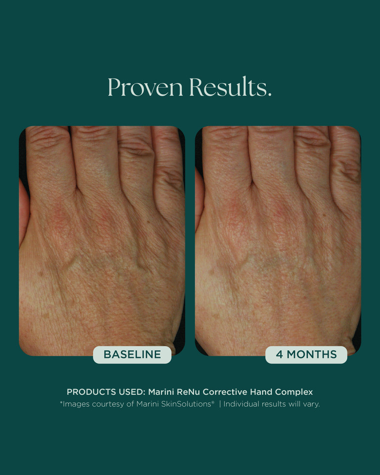 Marini Renu Hand Complex 28g