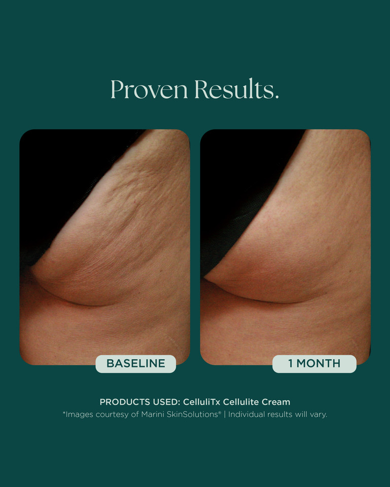 Marini CelluliTx 114g