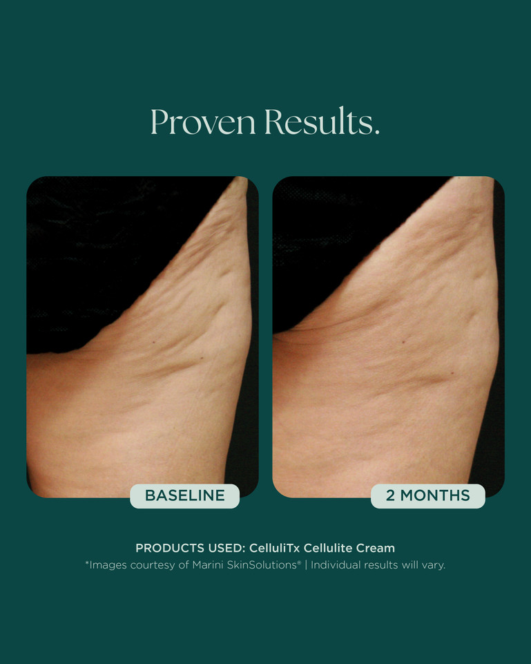 Marini CelluliTx 114g
