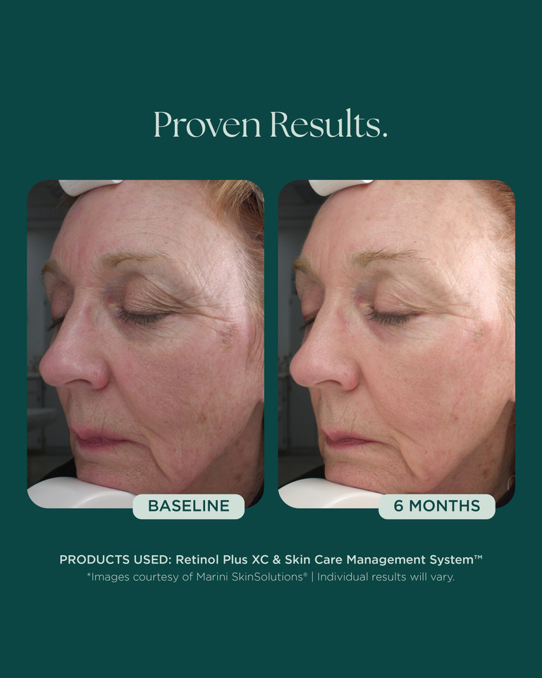 Retinol Plus XC 28g