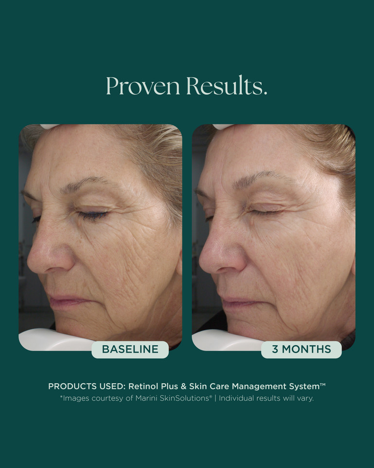 Retinol Plus 28g
