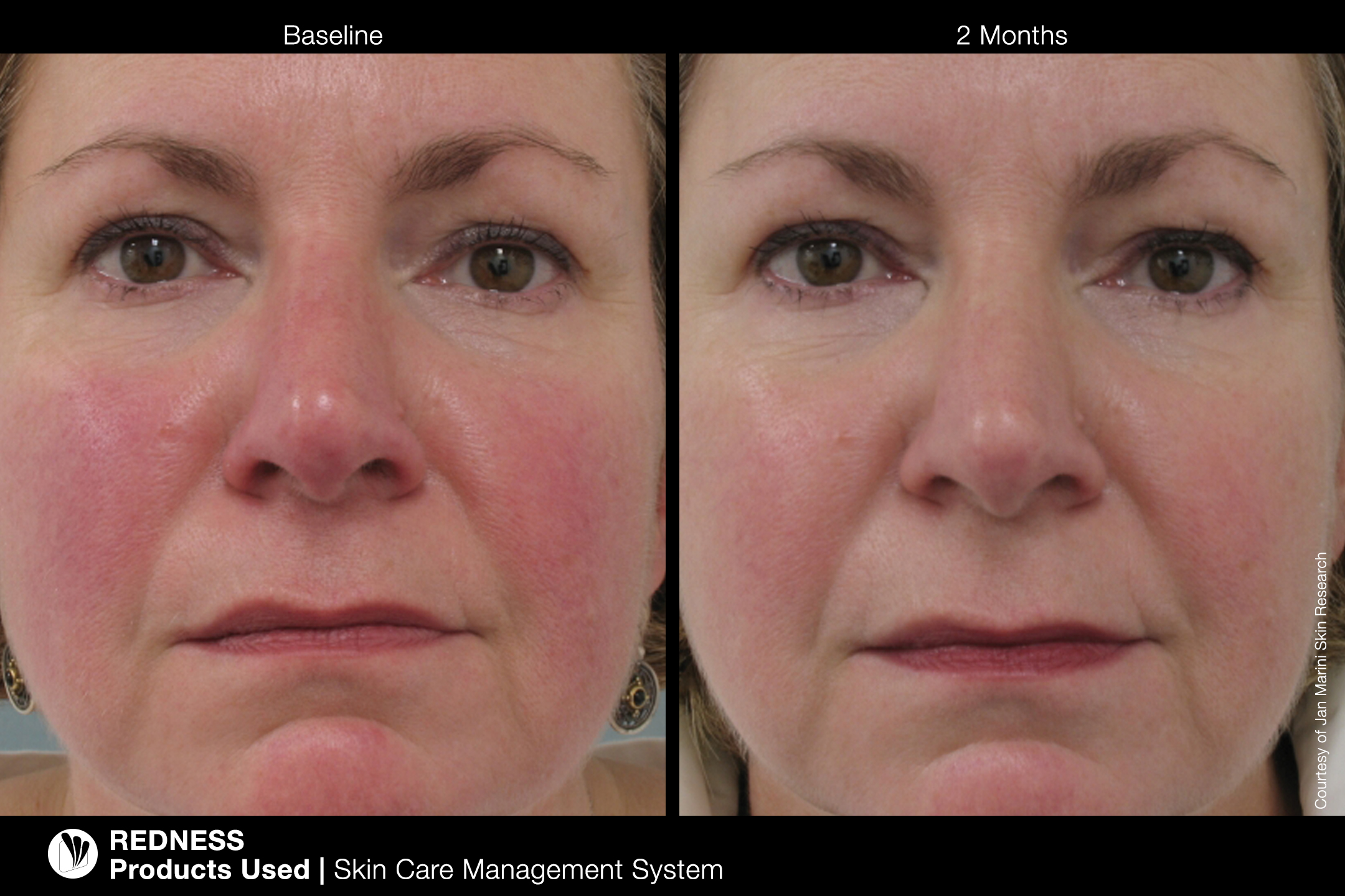 skin care management system b and a.jpeg?t=1613365446& ga=2.82340948.376031666.1613364619 1378866646