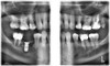 Planmeca PLANMECA PROMAX 3D Classic Panorex Cone Beam Planmeca PLANMECA PROMAX 3D Classic Panorex Cone Beam