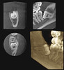 Planmeca PLANMECA PROMAX 3D Classic Panorex Cone Beam Planmeca PLANMECA PROMAX 3D Classic Panorex Cone Beam